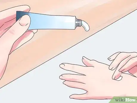 Image intitulée Treat Embarrassing Water Warts Step 7