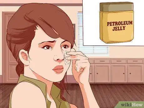 Image intitulée Treat a Facial Burn from a Curling Iron to Prevent Scars Step 4