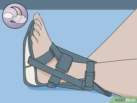 Image intitulée Get Rid of Heel Spurs Step 2