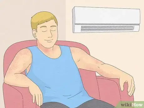 Image intitulée Treat Heat Rash Step 2