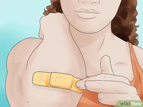 Image intitulée Treat Carpet Burns Step 5