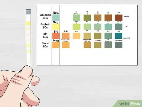 Image intitulée Use a Urine Dipstick Test Step 7