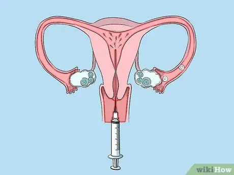 Image intitulée Raise the Chances of Having a Boy Step 6