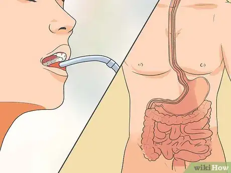Image intitulée Treat Heartburn Step 16