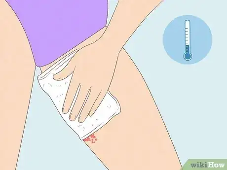 Image intitulée Get Rid of a Rash Between Your Legs Step 3