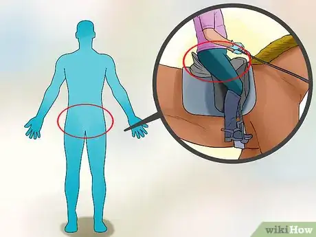 Image intitulée Diagnose Cauda Equina Syndrome Step 4