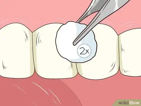 Image intitulée Pull a Loose Tooth at Home Step 7