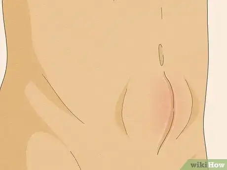 Image intitulée Treat Constipation After Hernia Surgery Step 16
