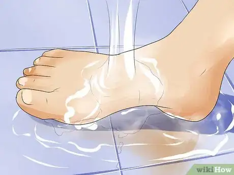 Image intitulée Treat Carpet Burns Step 6