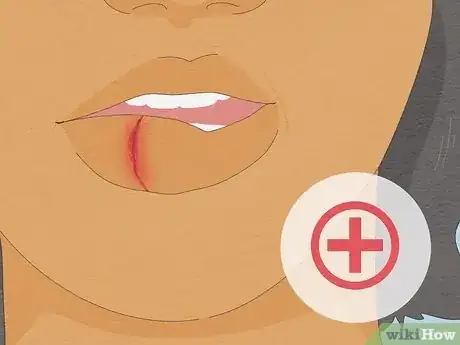 Image intitulée Treat a Cut Lip Step 10