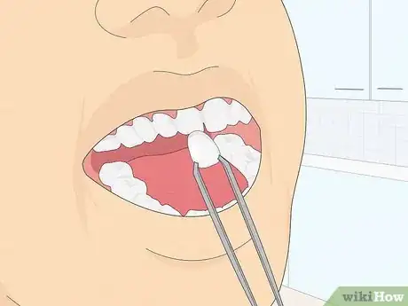 Image intitulée Fix Crooked Teeth Step 14