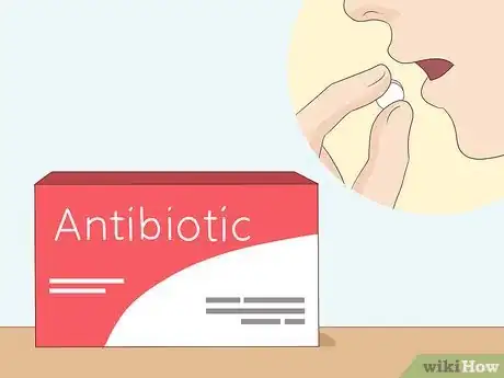 Image intitulée Clear a Blocked Tear Duct Step 9