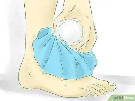 Image intitulée Return to Running After a Stress Fracture Step 14