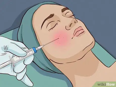 Image intitulée Get Rid of Acne Redness Step 11