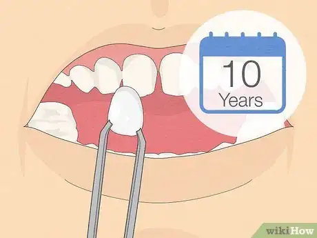 Image intitulée Fix Crooked Teeth Step 17