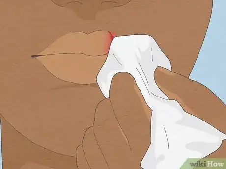Image intitulée Treat a Cut Lip Step 12