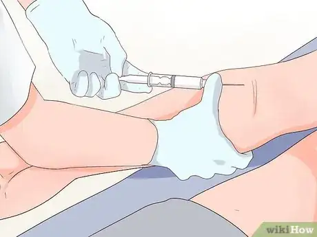 Image intitulée Recognize Syphilis Symptoms Step 9