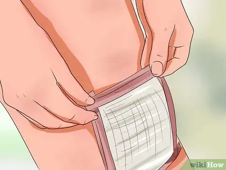 Image intitulée Treat Road Rash Step 14