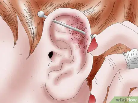 Image intitulée Get an Industrial Piercing Step 21.jpeg