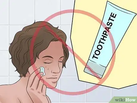 Image intitulée Decrease the Size of a Pimple Overnight Step 3