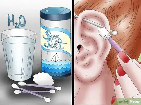 Image intitulée Get an Industrial Piercing Step 17.jpeg