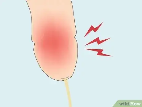 Image intitulée Treat Pain and Swelling in the Testicles Step 10