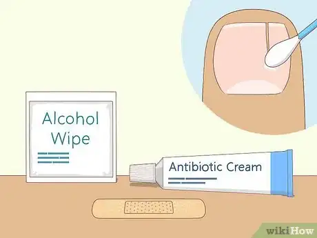 Image intitulée Heal Damaged Nails Step 2