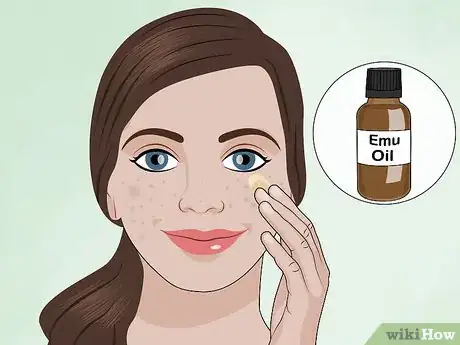 Image intitulée Apply a TCA Peel Step 15