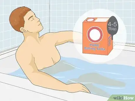 Image intitulée Treat Sand Flea Bites Step 4
