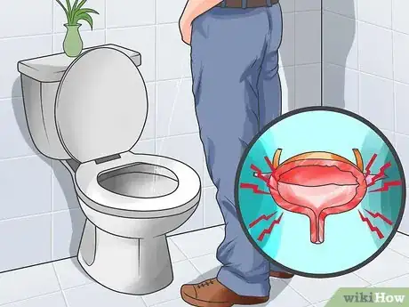 Image intitulée Know if You Have Prostate Cancer Step 6
