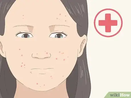 Image intitulée Have Clear Skin Naturally Step 23