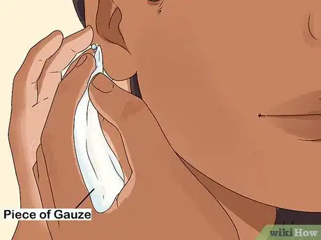 Image intitulée Clean a Cartilage Piercing Step 3