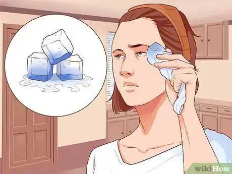 Image intitulée Treat a Facial Burn from a Curling Iron to Prevent Scars Step 3