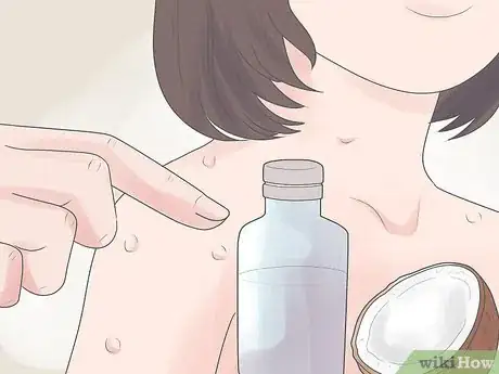 Image intitulée Treat Chickenpox at Home Step 24