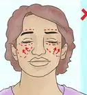 réduire la graisse du visage