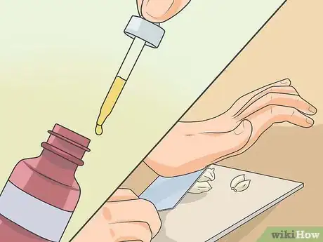 Image intitulée Treat Athlete's Foot Step 14