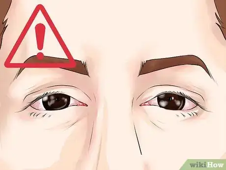Image intitulée Prevent Lymphedema Step 23