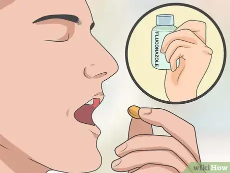 Image intitulée Treat Athlete's Foot Step 15
