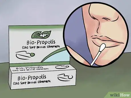 Image intitulée Prevent a Cold Sore from Forming Step 12