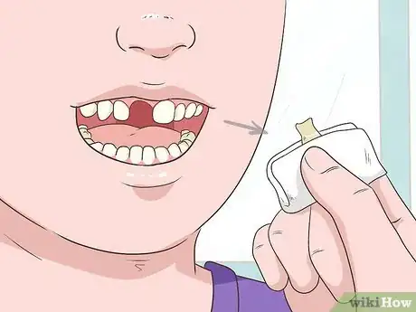 Image intitulée Pull a Loose Tooth at Home Step 9