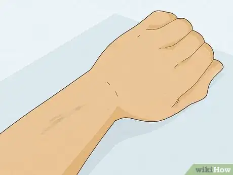 Image intitulée Remove Sharpie Ink from Skin Step 9