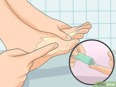 Image intitulée Treat Athlete's Foot Step 10