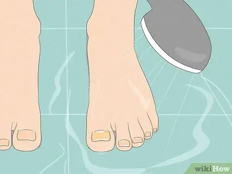 Image intitulée Remove a Dead Toenail Step 7