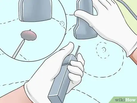 Image intitulée Know if You Have Breast Cancer Step 17