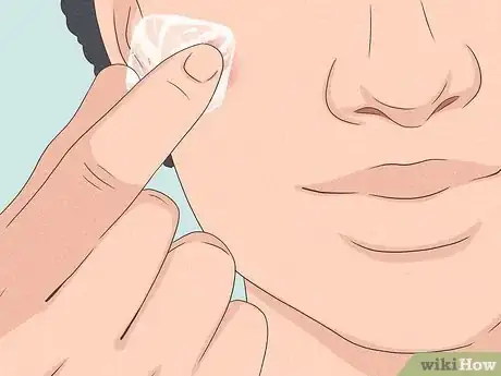 Image intitulée Get Rid of a Zit Overnight Step 8