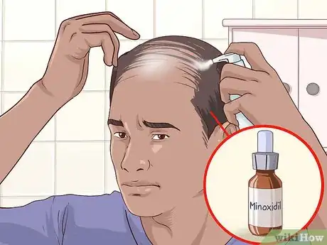 Image intitulée Regrow Hair Step 3