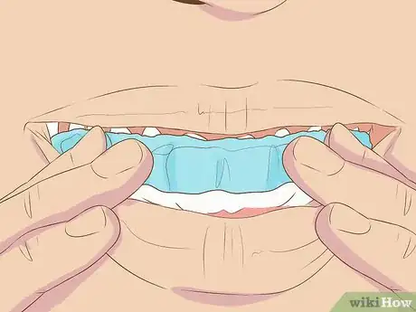 Image intitulée Make Fake Braces or a Fake Retainer Step 15