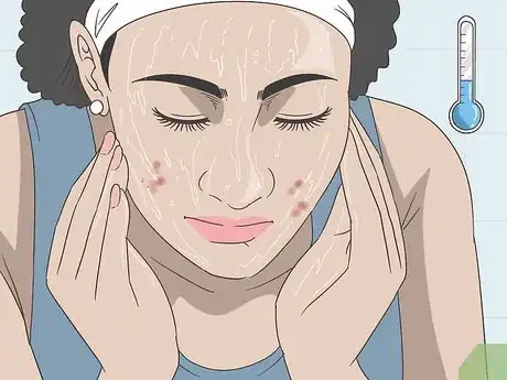 Image intitulée Create a Hot Compress for Acne Treatment and Skin Health Step 9