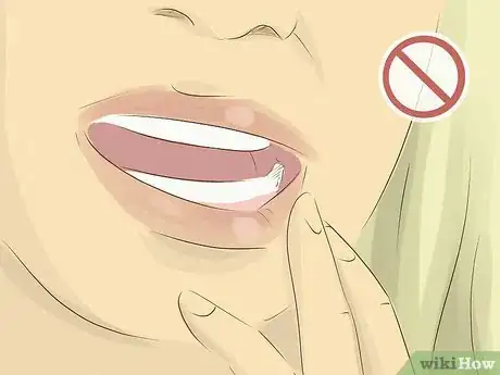 Image intitulée Recover after Wisdom Teeth Surgery Step 2