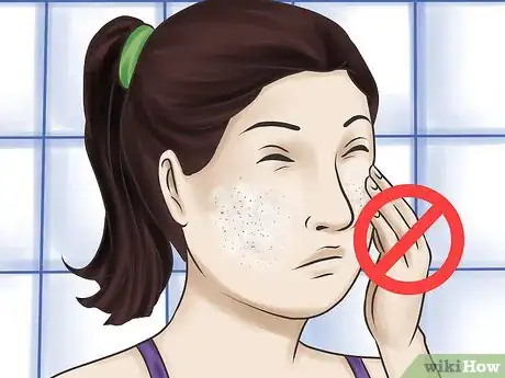Image intitulée Use Aloe Vera for Acne Step 11